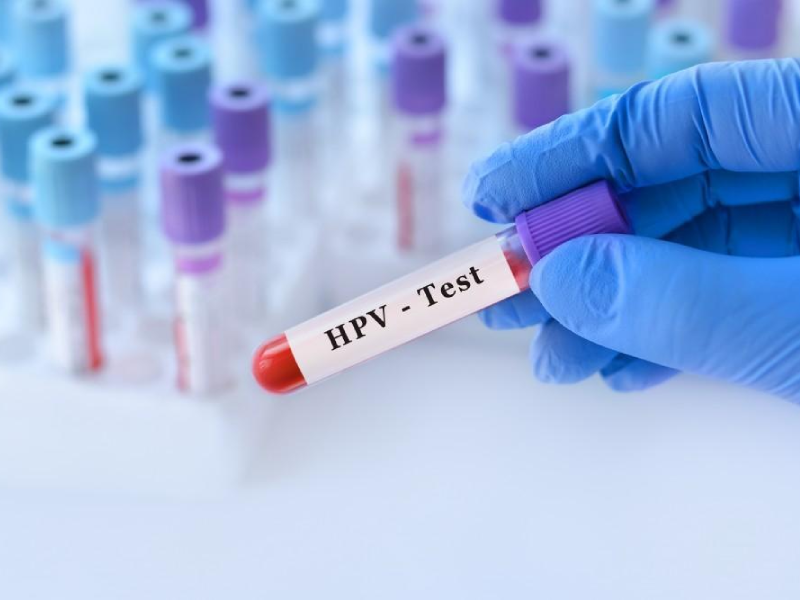 ویروس HPV در خارج از بدن انسان به سرعت از بین می‌رود